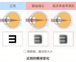 眼涩眼干眼疲劳流泪用什么药水