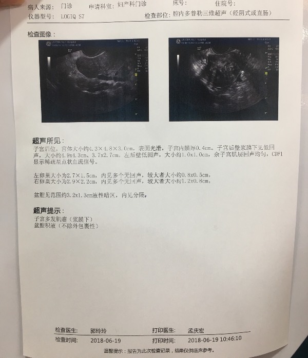 子宫肌瘤最怕三个运动尿道放了双丿管为什么就尿pieng