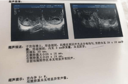 怀孕多久可以做b超查宫内宫外