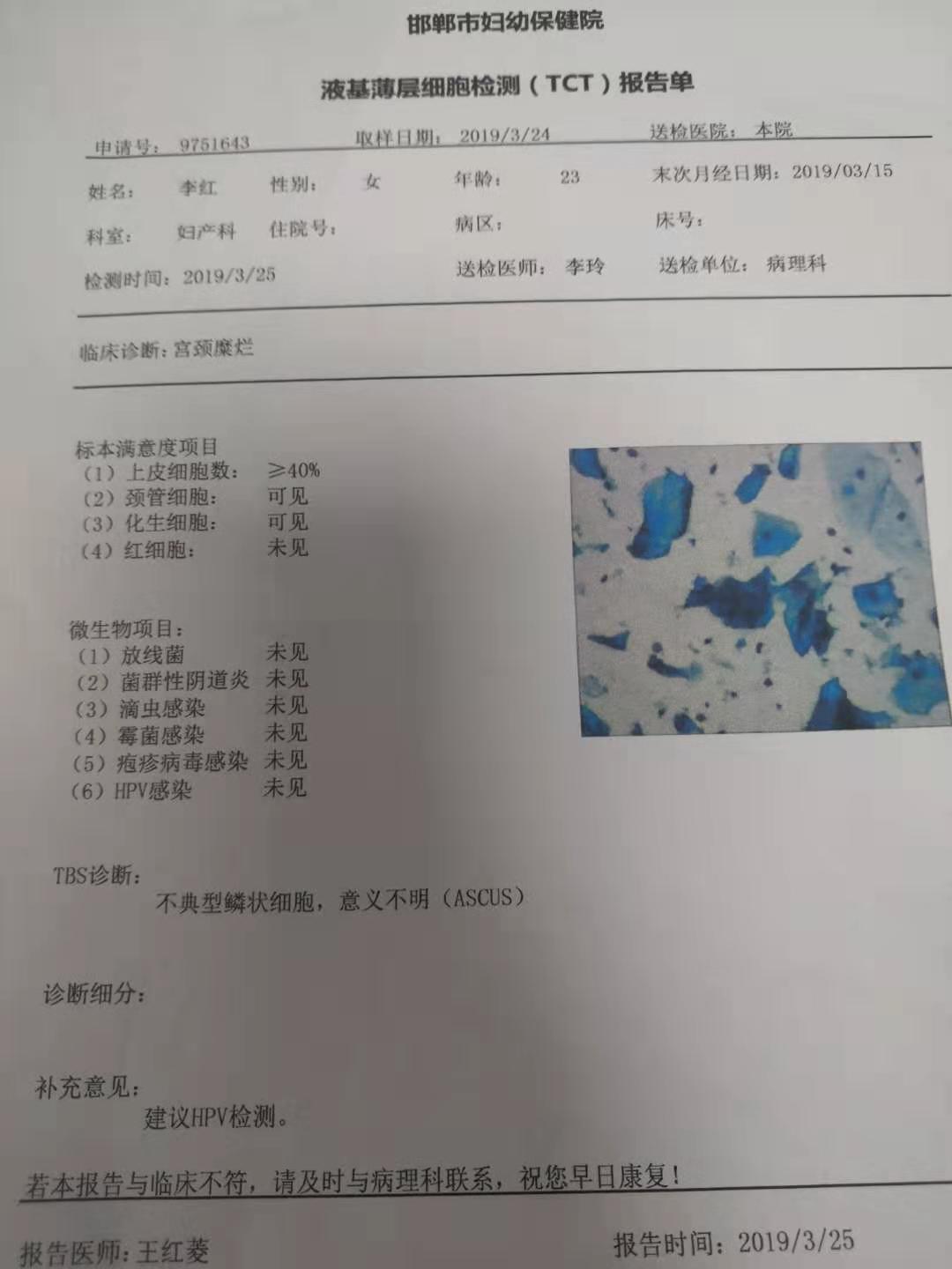 hpv是艾滋病吗图片