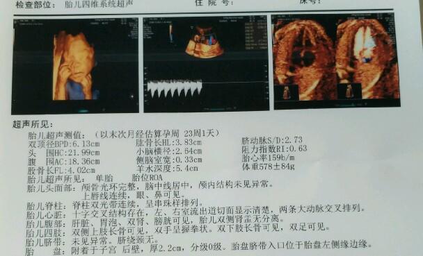 四维彩超在观察胎儿性别方面的准确性及其全面数据策略实施，最新方案解析_ChromeOS35.39.37