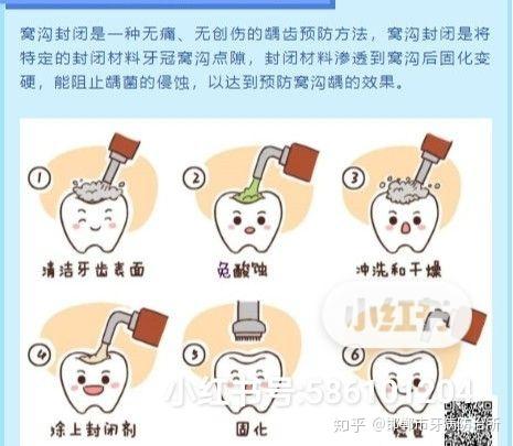 儿童窝沟封闭策略，牙齿保护与数据导向执行策略的重要性，实地验证数据策略_制版72.29.90