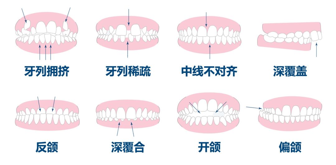 关于补牙齿的费用解读，一颗牙齿的修补成本与选择医院的考量因素，全面解析说明_进阶款65.37.68