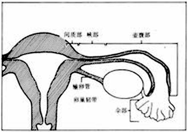 输卵管积液可以不治吗